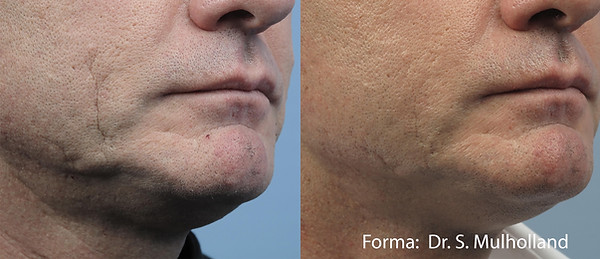 Forma in Mill Hill